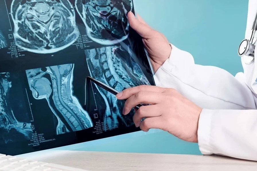 Bác sĩ đang phân tích hình ảnh chụp CT để chẩn đoán ung thư
