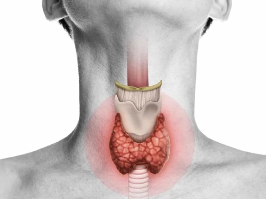 Hình ảnh minh họa vị trí tuyến giáp ở vùng cổ nơi ung thư tuyến giáp phát triển