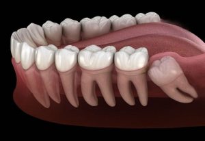 Nha khoa Nhổn nào phù hợp? Dịch vụ, địa chỉ và những điều cần biết
